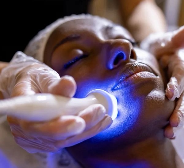 Facial Cryotherapy
